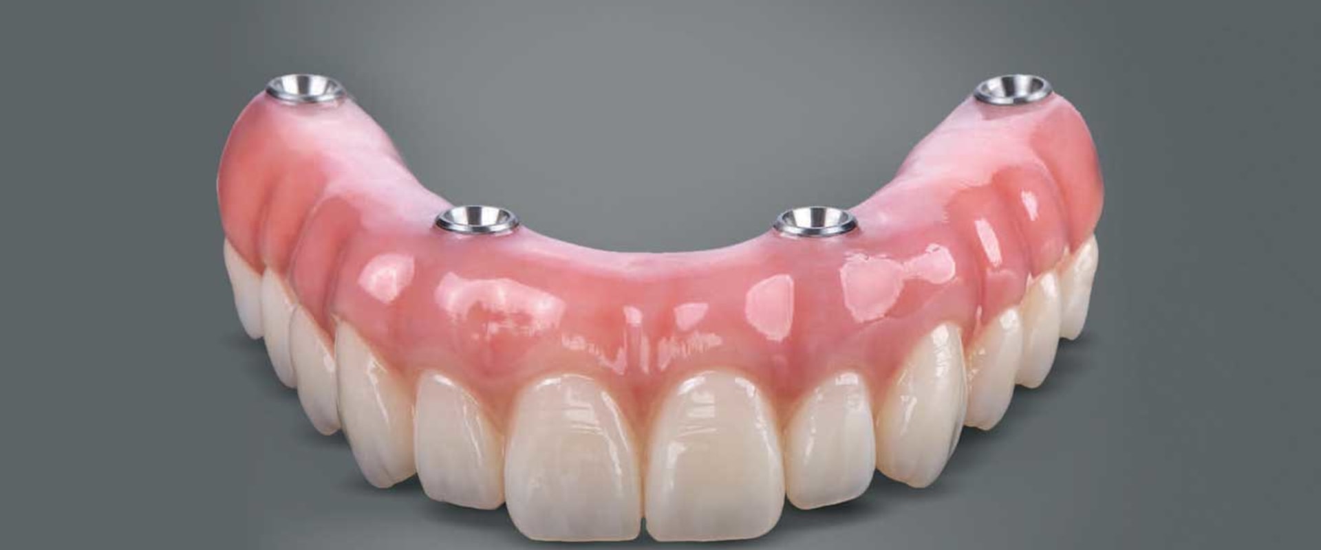What Materials are Used for All-on-4 Dental Implants?